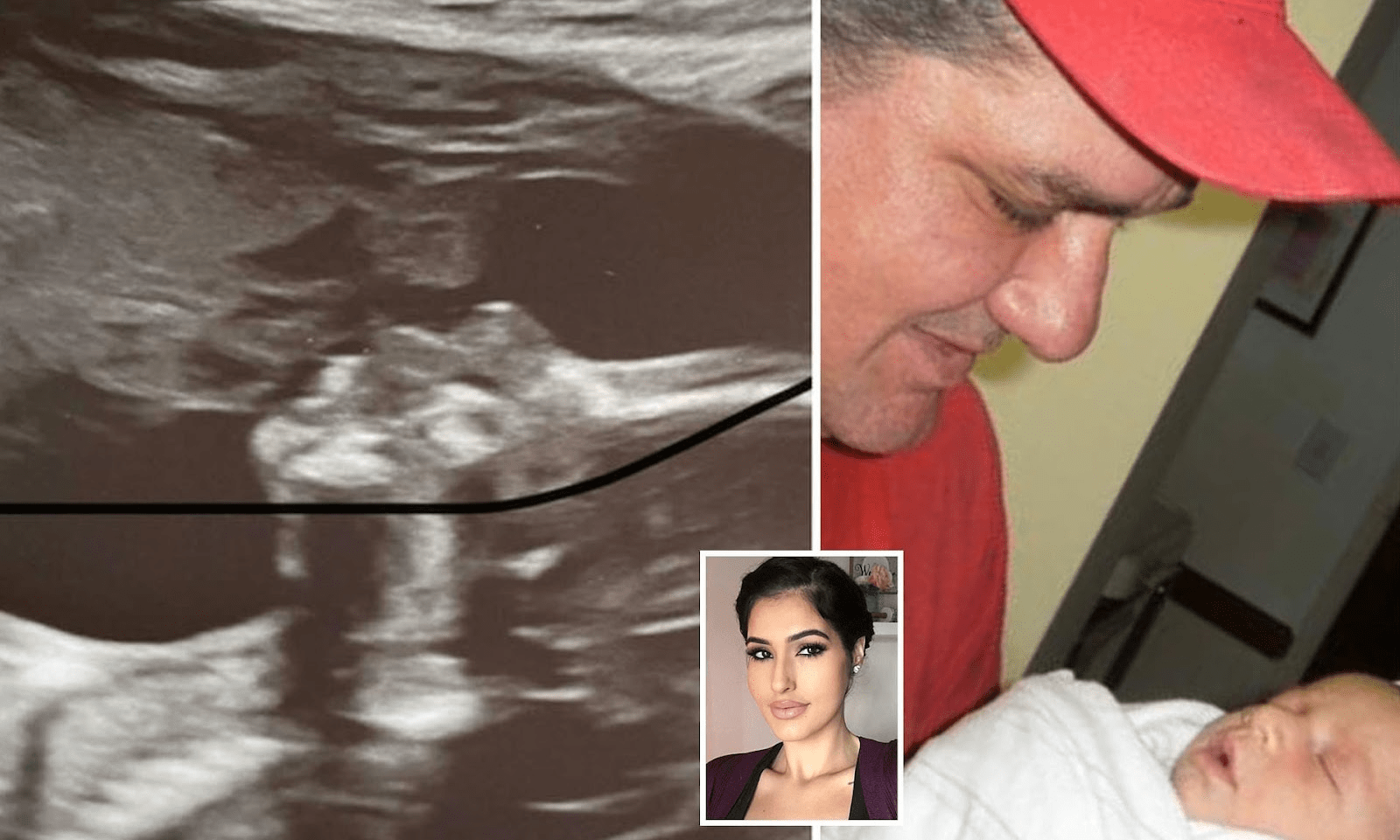 Pregnant woman believes angel kissing her unborn in sonogram